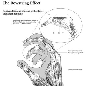 A cropped greyscale diagram of a flexed hand 